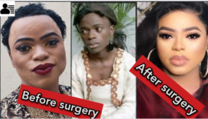 bobrisky before surgery